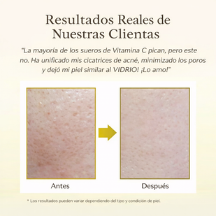 Resultados rápidos y sin complicaciones