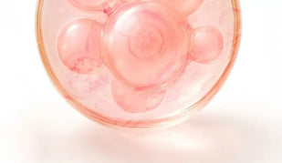 Filtrado de fermento degalactomyces