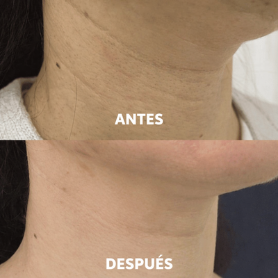 Mascarilla Reafirmante para el Cuello